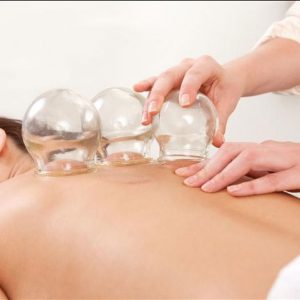 cupping-therapy enSonseca